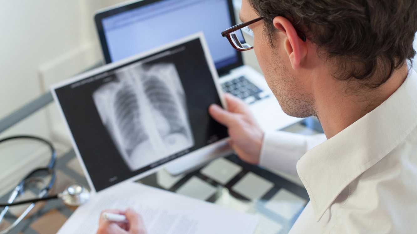 Akciğer Kanseri Nedir? Akciğer Kanseri Neden Olur, Belirtileri ve Tedavisi