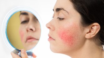 Ataksi Telenjiektazi Nedir? Ataksi Telenjiektazi Neden Olur, Belirtileri ve Tedavisi