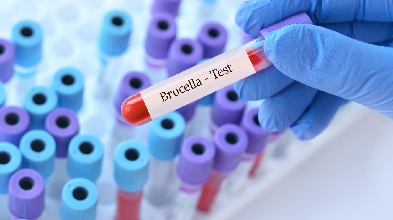 Brusella Nedir? Brusella Hastalığı Belirtileri Nelerdir?
