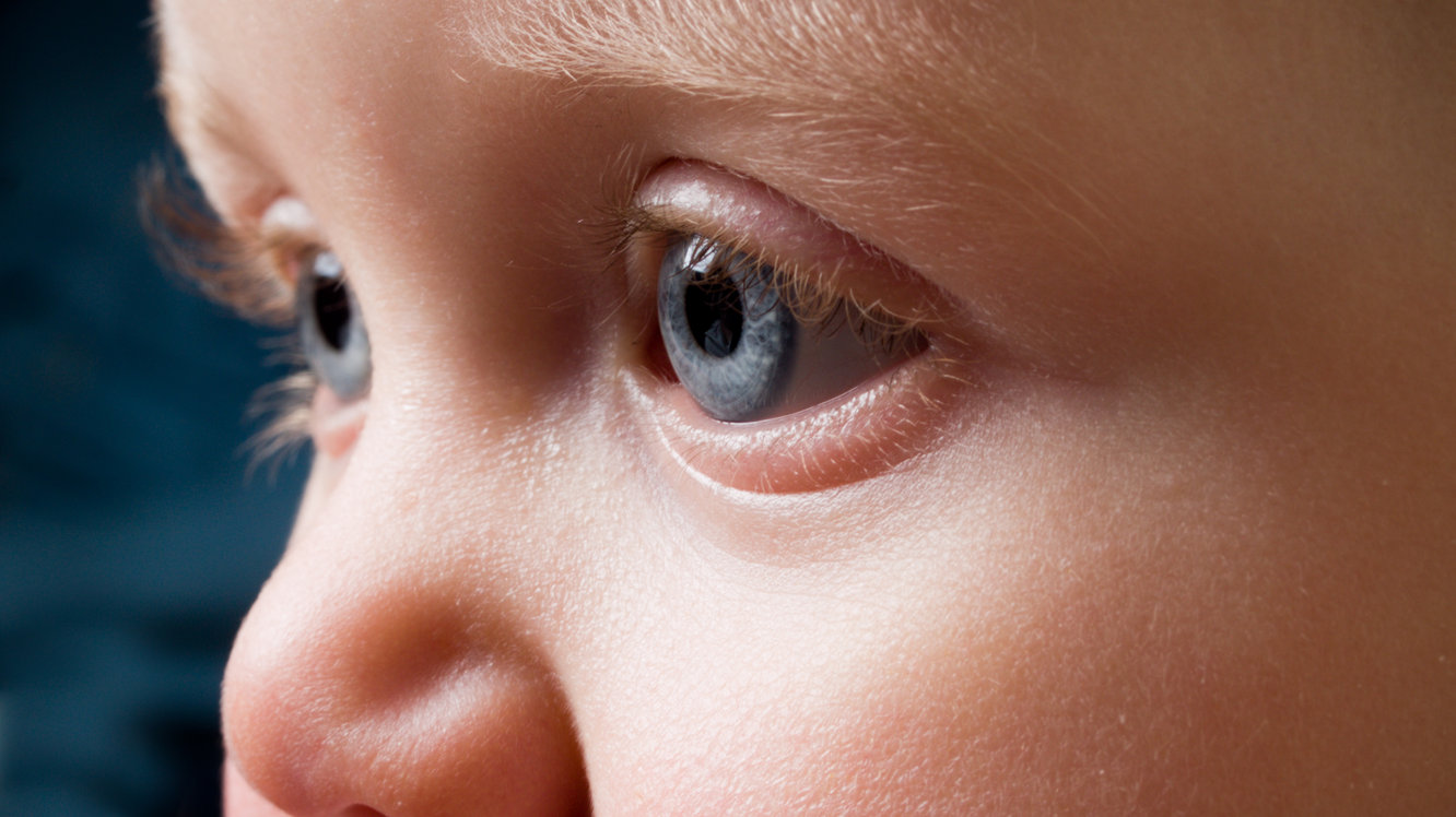 Çocuklarda Retinoblastom Nedir? Belirtileri ve Tedavisi