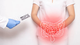 Divertikülit Nedir? Divertikülit Belirtileri Nelerdir?