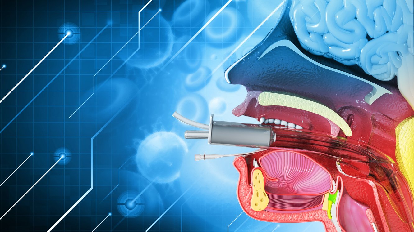 Entübe Nedir? Entübasyon Hangi Durumlarda ve Neden Yapılır?