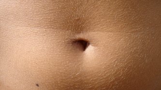 Göbek Deliği İltihabı Nedir? Belirtileri ve Tedavisi