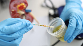 İdrar Kültürü Nedir? İdrar Kültürü Neden Yapılır?