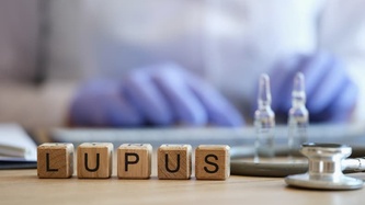 Kelebek Hastalığı (Lupus) Nedir? Belirtileri Nelerdir?