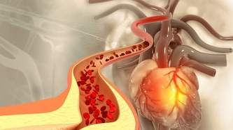 Kolesterol Nedir? Kolesterol Yüksekliği Belirtileri Nelerdir?