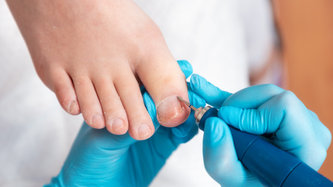 Mantar Hastalığı Nedir? Mantar Hastalığı Nasıl Geçer?