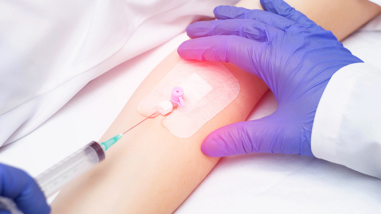 Monosit (MON) Nedir? Monosit Belirtileri, Nedenleri ve Tedavisi