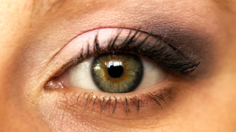 Nistagmus (Göz Titremesi) Nedir? Belirtileri ve Tedavisi