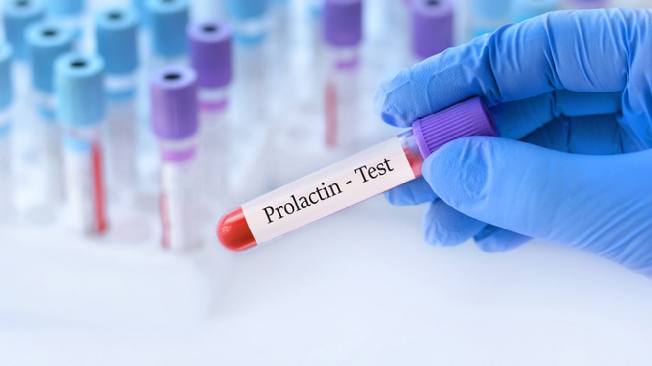 Prolaktin Nedir? Prolaktin Yüksekliği Nedenleri Nelerdir?