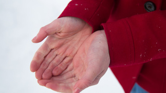 Raynaud Sendromu Nedir? 