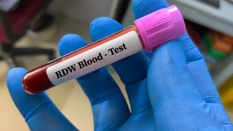 RDW Nedir? Kanda RDW Yüksekliği ve Düşüklüğü