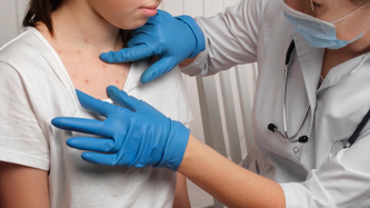 What You Need to Know About Chickenpox