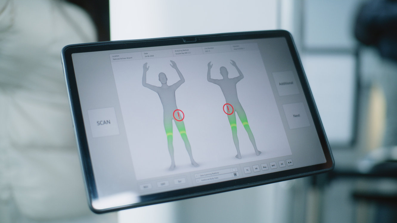 Tüm Vücut Haritalama Yöntemiyle Ben Taraması