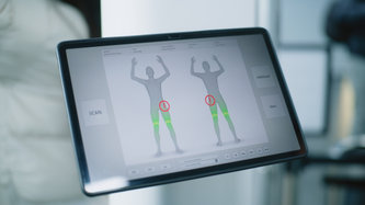 Tüm Vücut Haritalama Yöntemiyle Ben Taraması