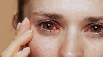 Üveit Nedir? Üveit Belirtileri Nelerdir?