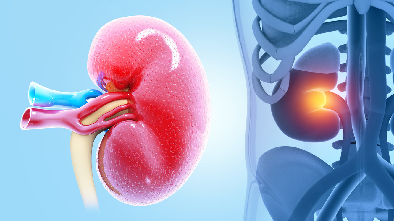 Wilms Tümörü (Nefroblastom) Nedir? Belirtileri ve Tedavisi