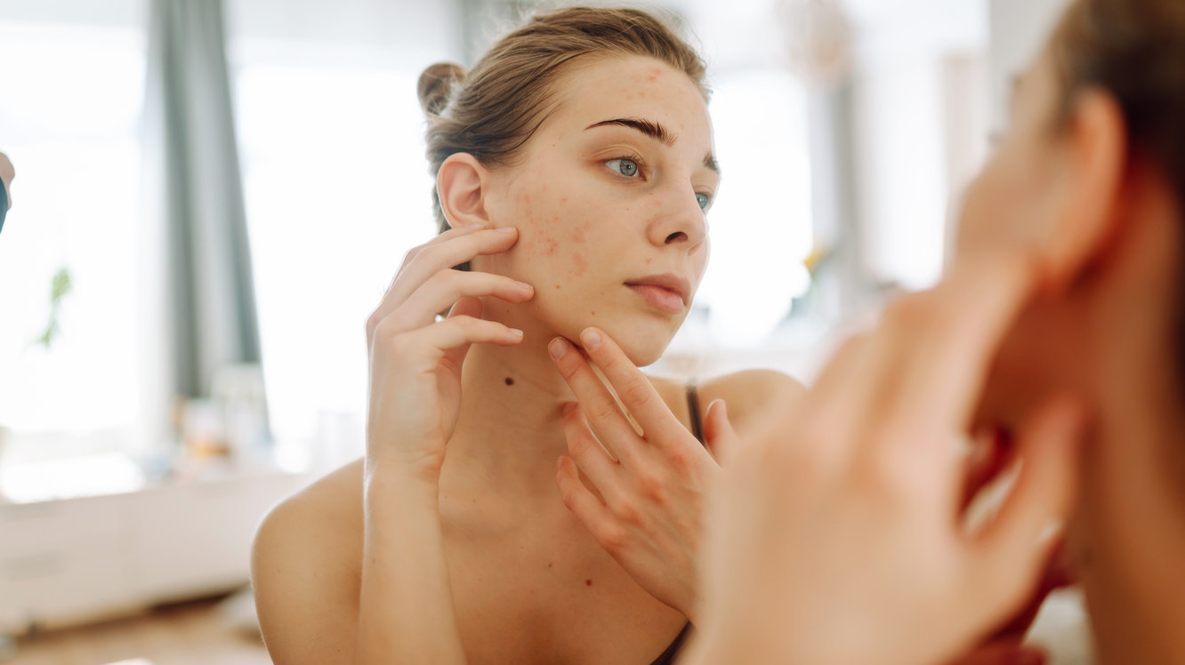 İzotretinoin Nedir? İzotretinoin Ne İşe Yarar?