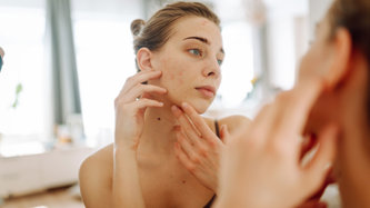 İzotretinoin Nedir? İzotretinoin Ne İşe Yarar?